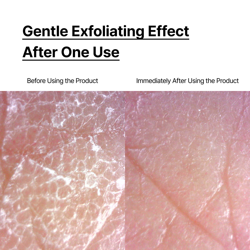 Apple Amino Acids Exfoliating LHA Bodywash