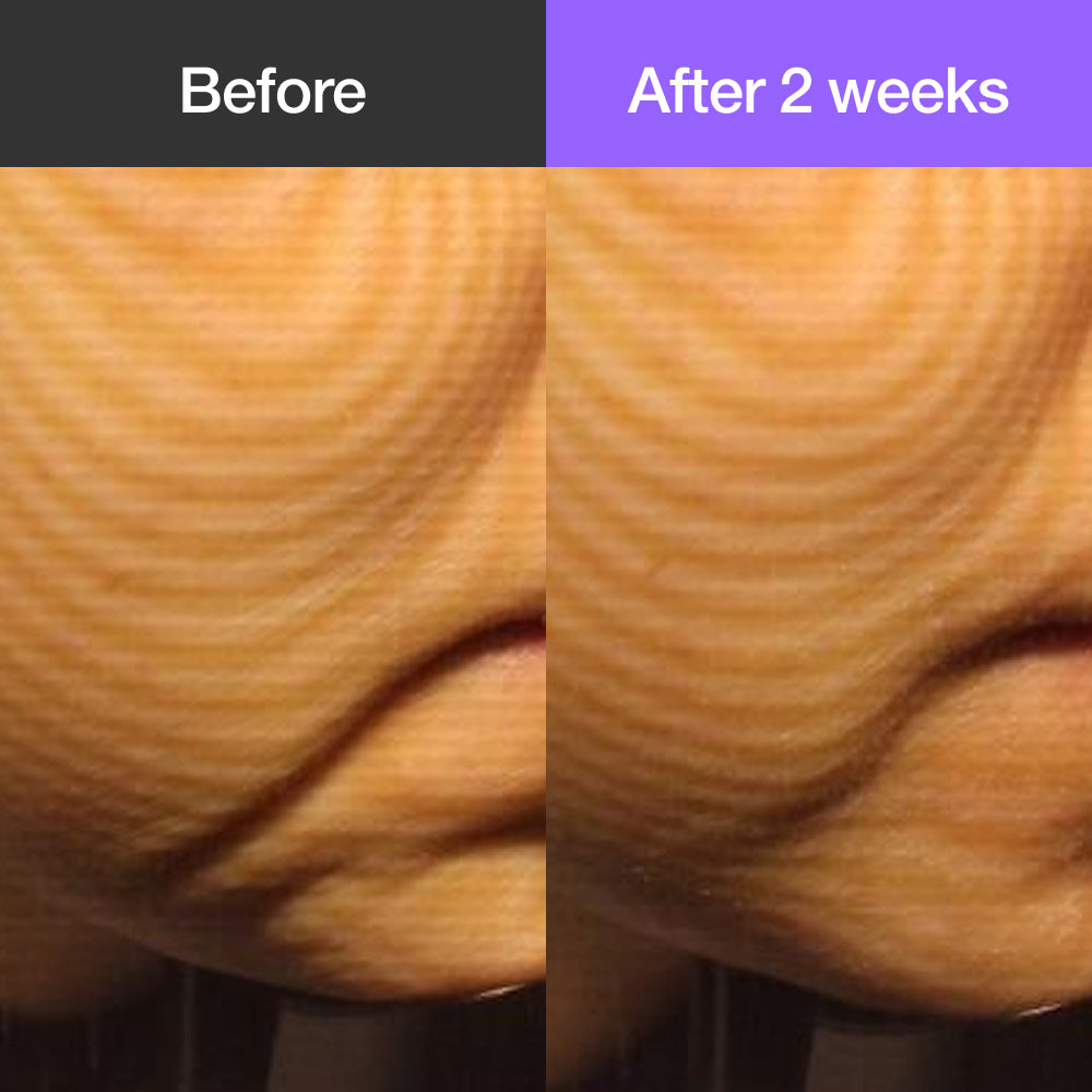 Sharpting Punica Jelly Cream Epu-D